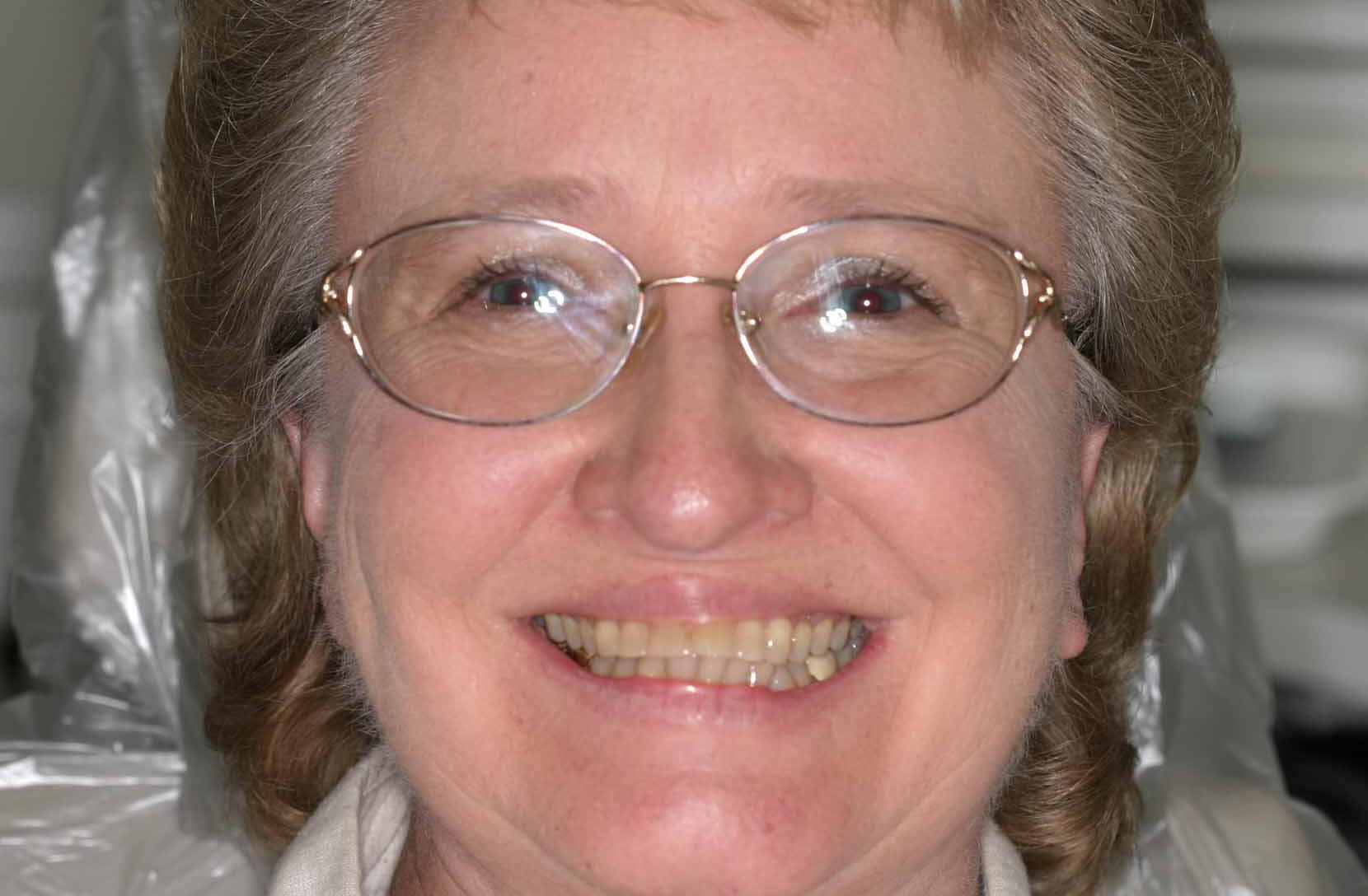 Cosmetic Dentist Fort Myers Cape Coral Naples FL